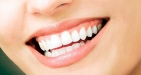 Express Teeth Whitening